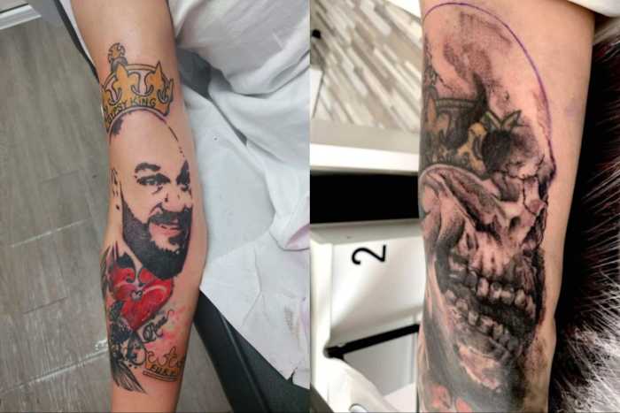Former Tyson Fury super fan Anna Sinclair has her tattoo of "The Gypsy King" covered with skull ink.